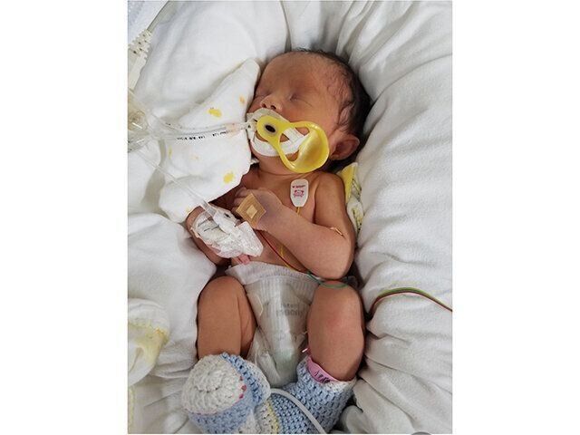 双子の医療的ケア児育児体験談　チャージ症候群・免疫不全・弱視難聴