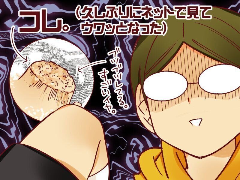 尋常性疣贅（じんじょうせいゆうぜい）とは…？！【御手洗直子のコマダム日記 ＃147】