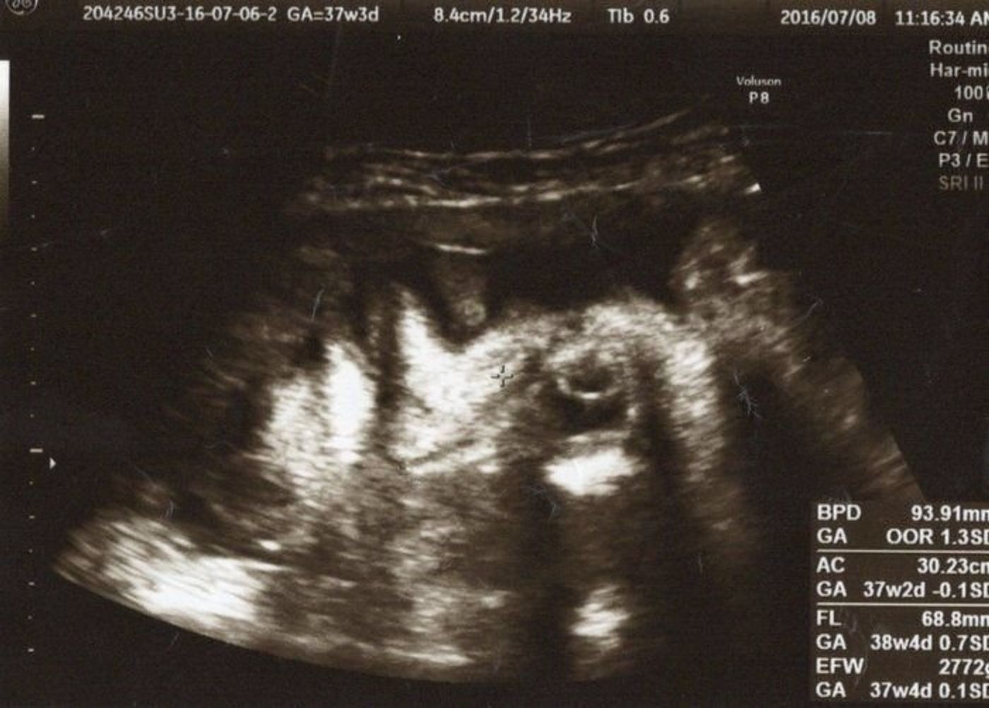 妊娠37週 赤ちゃんのエコー写真 超音波写真まとめ たまひよ 妊娠37週 赤ちゃんのエコー写真 超音波写真まとめ たまひよ