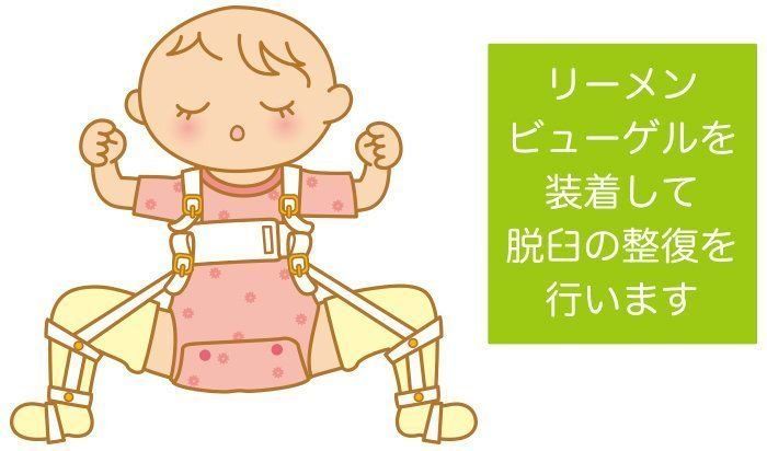 赤ちゃんの骨 関節の病気 先天性股関節脱臼の症状とケア 医師監修 たまひよ