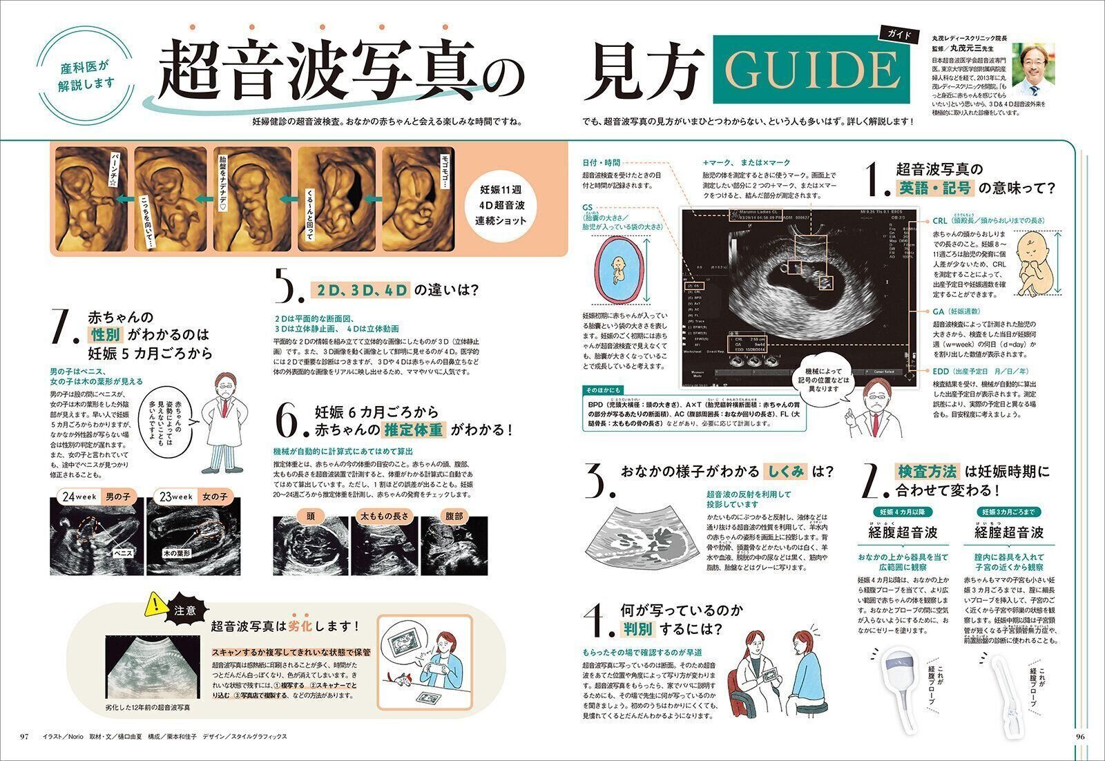 【特集】産科医が解説します 超音波写真の見方ガイド