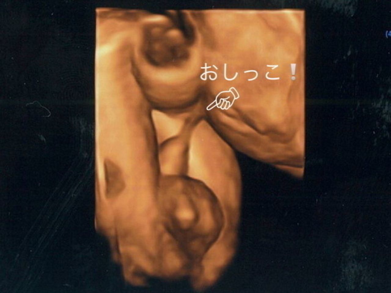 超音波写真でここまで見える おなかの中で赤ちゃんのおしっこシーンを激写 たまひよ 超音波写真でここまで見える おなかの中で赤ちゃんのおしっこシーンを激写 たまひよ