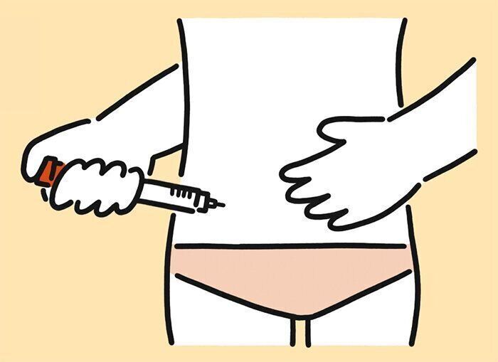 【低ゴナドトロピン性性腺機能低下症】どんな手術をする？