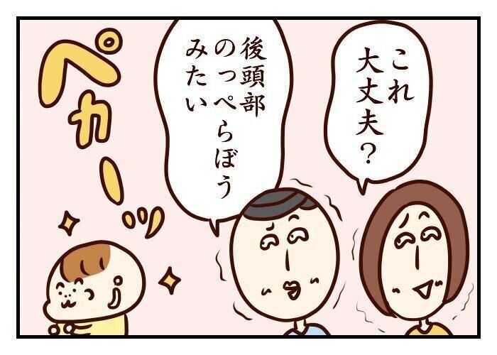 赤ちゃんの寝ハゲが激しすぎて 噛みしめ育児スルメ日記 71 たまひよ