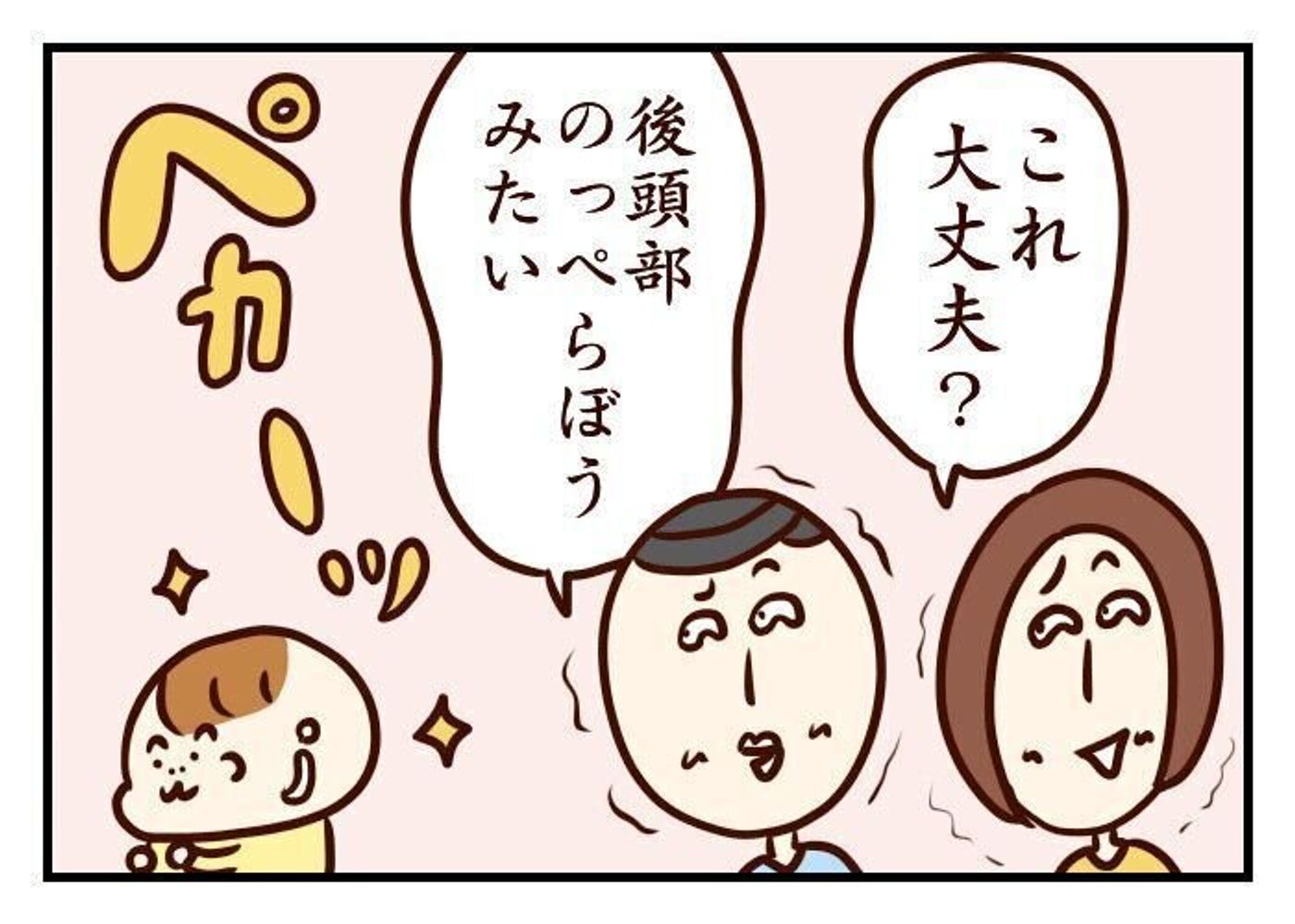 赤ちゃんの寝ハゲが激しすぎて 噛みしめ育児スルメ日記 71 たまひよ 赤ちゃんの寝ハゲが激しすぎて 噛みしめ育児スルメ日記 71 たまひよ
