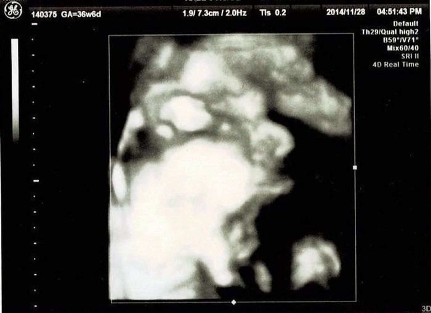 妊娠36週 赤ちゃんのエコー写真 超音波写真まとめ たまひよ 妊娠36週 赤ちゃんのエコー写真 超音波写真まとめ たまひよ