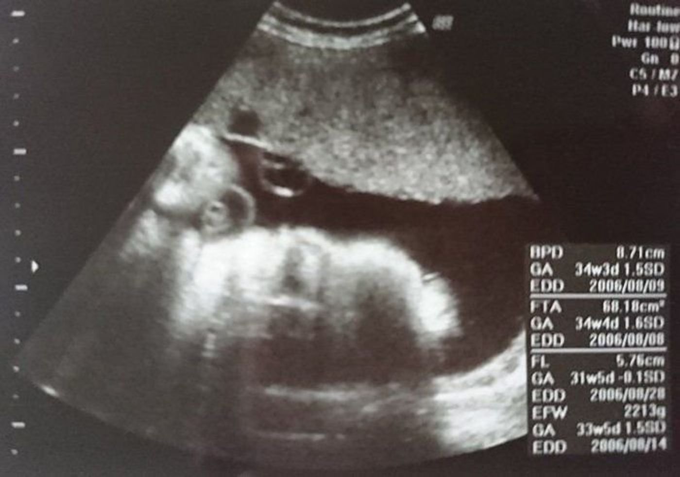 妊娠31週 赤ちゃんのエコー写真 超音波写真まとめ たまひよ 妊娠31週 赤ちゃんのエコー写真 超音波写真まとめ たまひよ