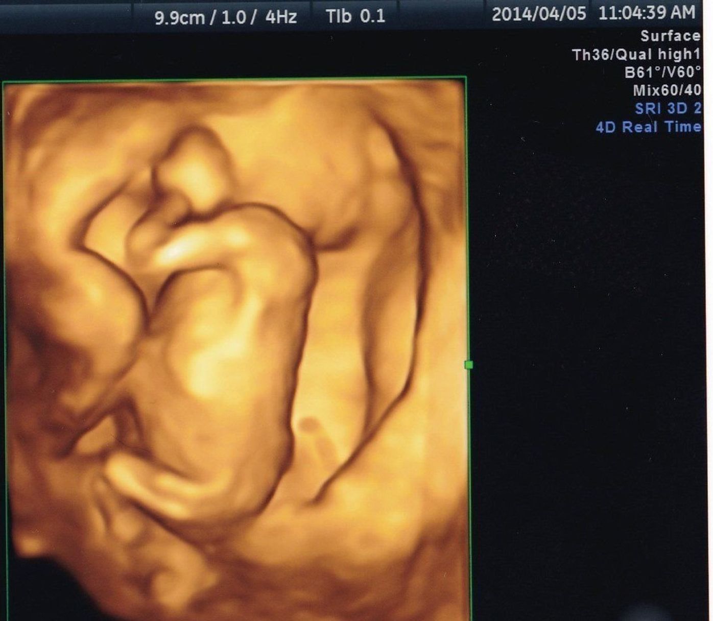 エコー画像で振り返る 私に宿った小さな命が大きく育って誕生するまでの記録 たまひよ エコー画像で振り返る 私に宿った小さな命が大きく育って誕生するまでの記録 たまひよ