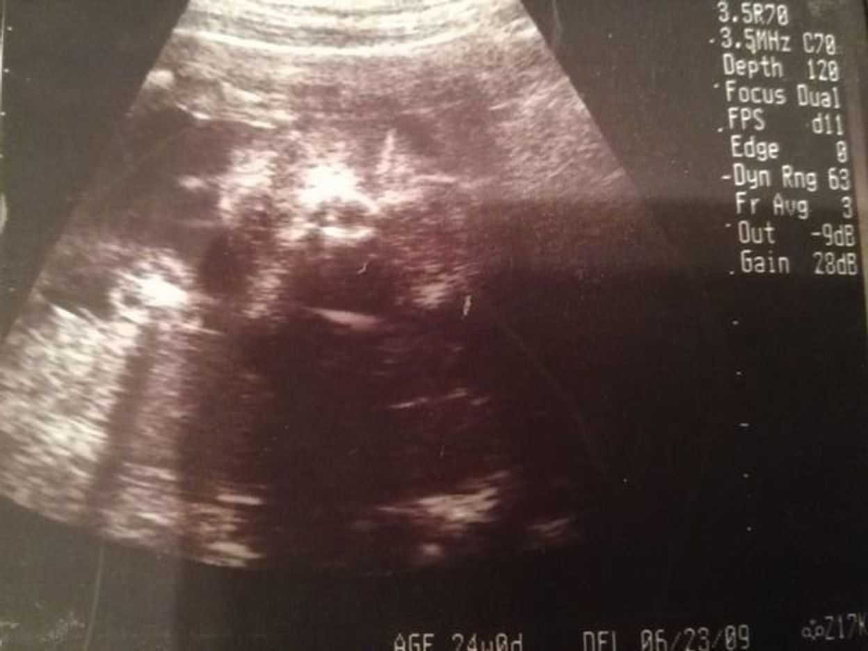 妊娠24週 赤ちゃんのエコー写真 超音波写真まとめ たまひよ 妊娠24週 赤ちゃんのエコー写真 超音波写真まとめ たまひよ