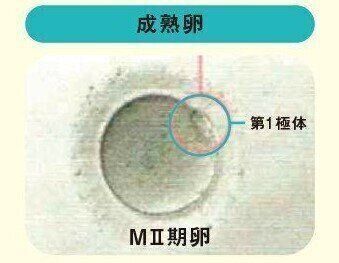 (M2期卵)第1極体(核)が出た卵を成熟卵といい、体外受精や顕微授精に使用できます。