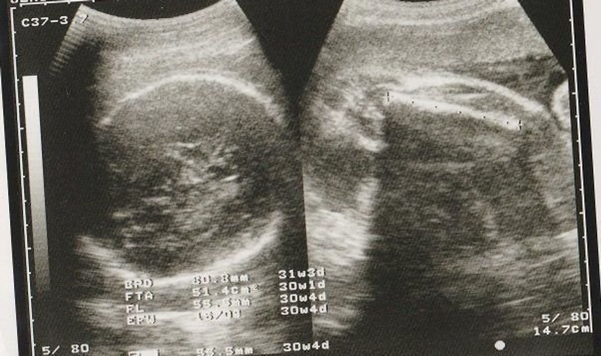 妊娠30週 赤ちゃんのエコー写真 超音波写真まとめ たまひよ 妊娠30週 赤ちゃんのエコー写真 超音波写真まとめ たまひよ