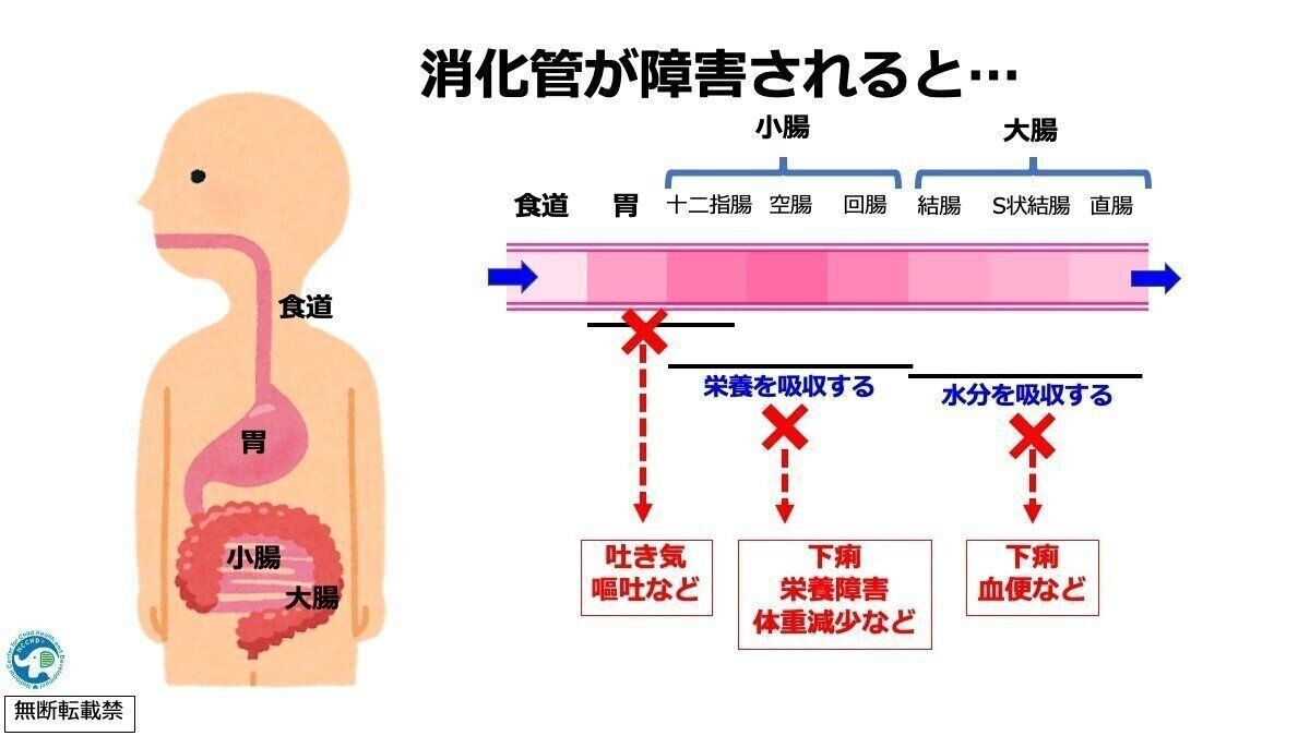 500人に1人の赤ちゃんが発症 繰り返す嘔吐や下痢を起こす 食物たんぱく誘発胃腸症 が増えている 専門医 たまひよ