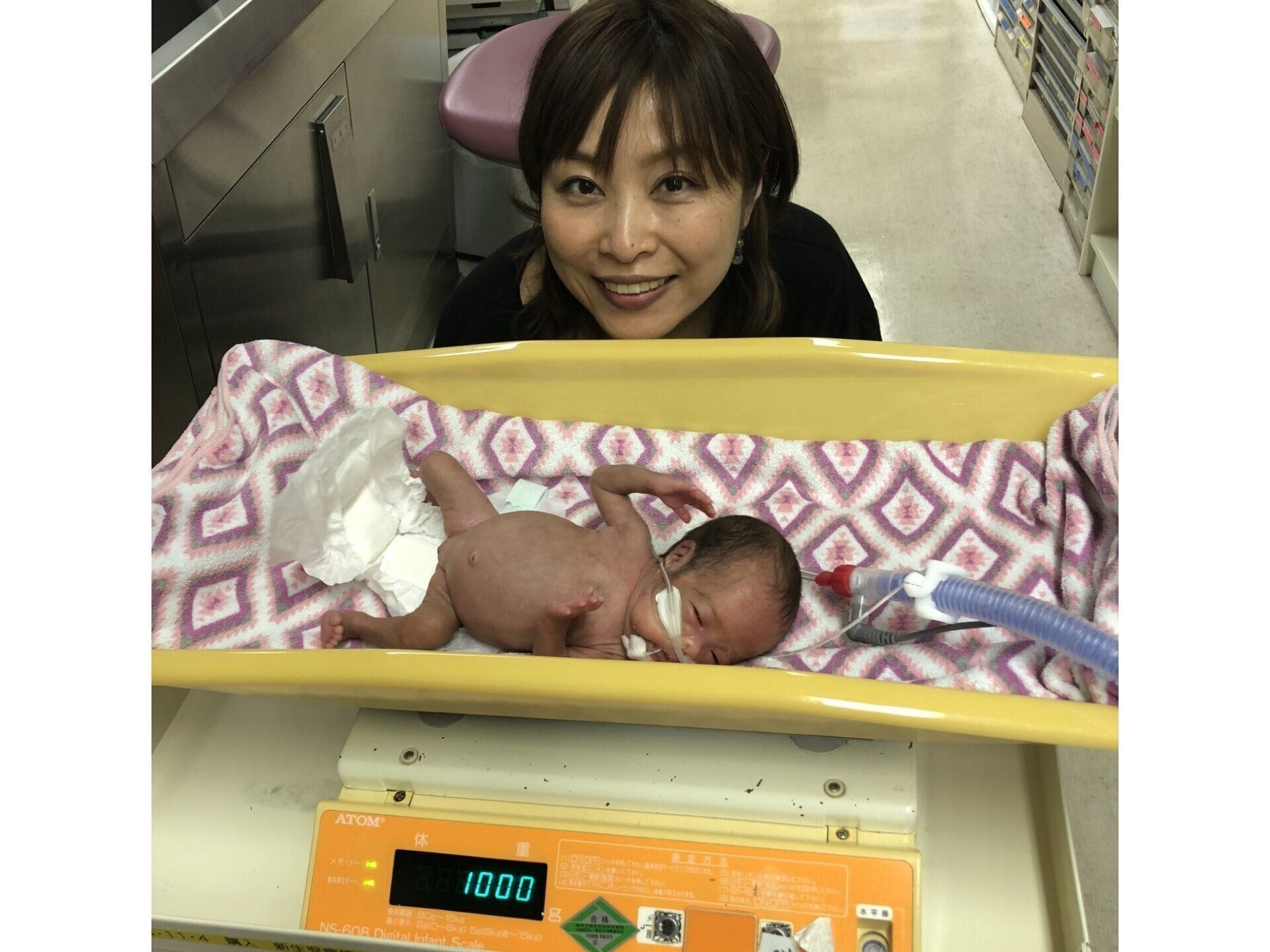 赤ちゃん わずか体重370gで生まれたわが子。「何があってもこの子と生き