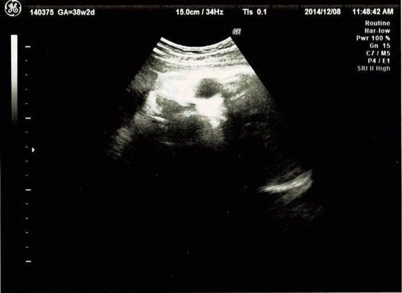 妊娠38週 赤ちゃんのエコー写真 超音波写真まとめ たまひよ 妊娠38週 赤ちゃんのエコー写真 超音波写真まとめ たまひよ