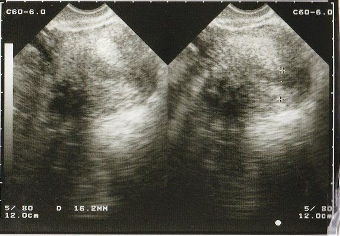 不妊治療や2度の流産経験を経て 初めての出産 日々成長する胎児の記録をエコー画像で振り返る たまひよ 不妊治療や2度の流産経験を経て 初めての出産 日々成長する胎児の記録をエコー画像で振り返る たまひよ