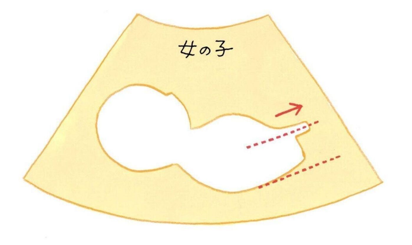 Snsで話題 健診よりも早く性別がわかる 胎児の性別判定方法 ベビーナブ って たまひよ Snsで話題 健診よりも早く性別がわかる 胎児の性別判定方法 ベビーナブ って たまひよ