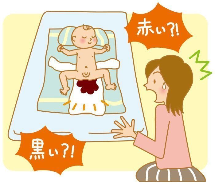 赤ちゃん 新生児の病気 急性胃粘膜病変 新生児メレナの症状とケア 医師監修 たまひよ