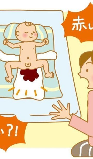 赤ちゃん 新生児の病気 急性胃粘膜病変 新生児メレナの症状とケア 医師監修 たまひよ