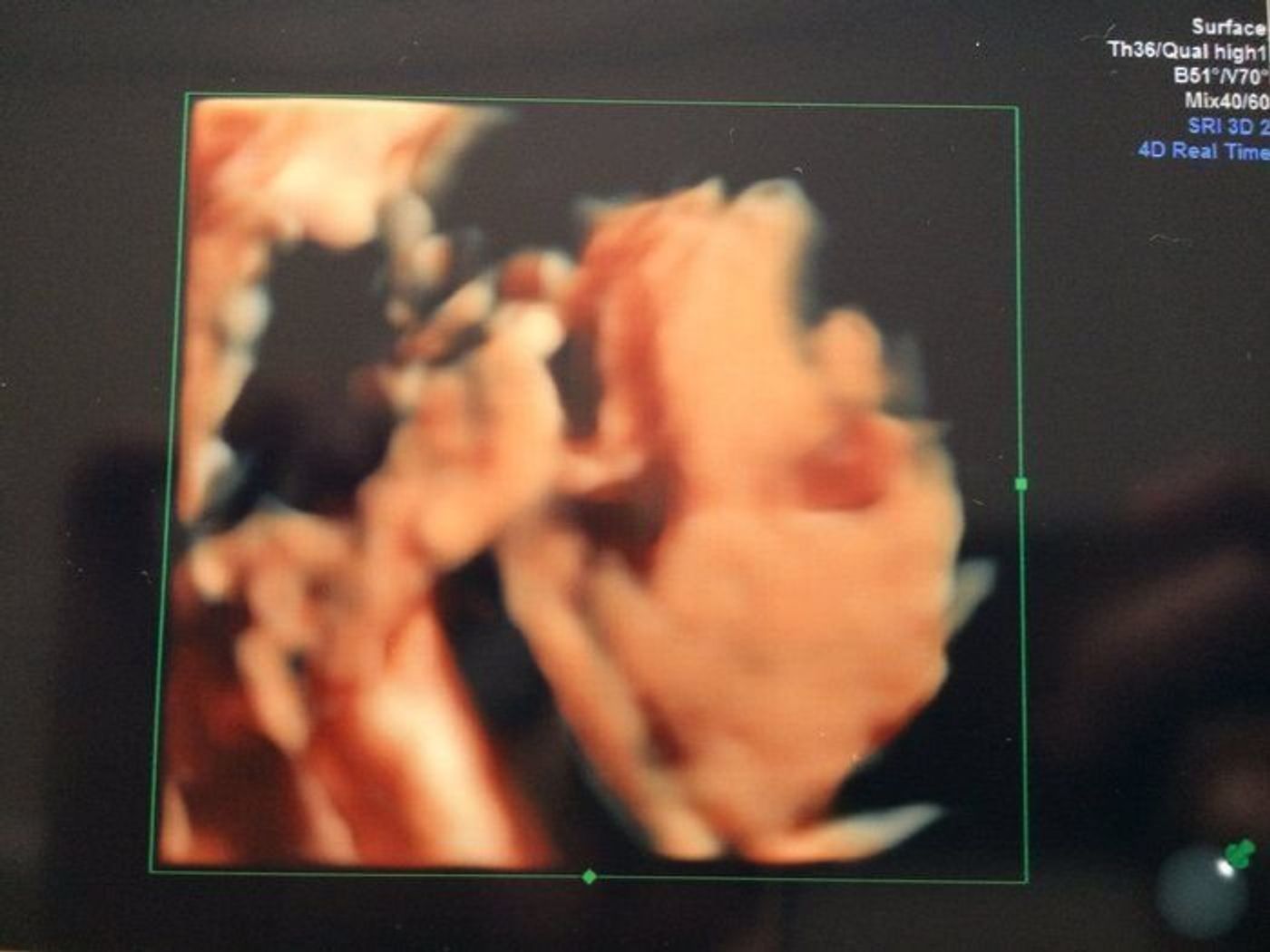 妊娠29週 赤ちゃんのエコー写真 超音波写真まとめ たまひよ 妊娠29週 赤ちゃんのエコー写真 超音波写真まとめ たまひよ