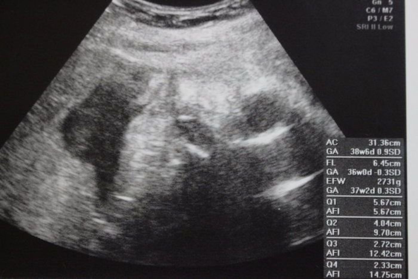 妊娠36週 赤ちゃんのエコー写真 超音波写真まとめ たまひよ 妊娠36週 赤ちゃんのエコー写真 超音波写真まとめ たまひよ