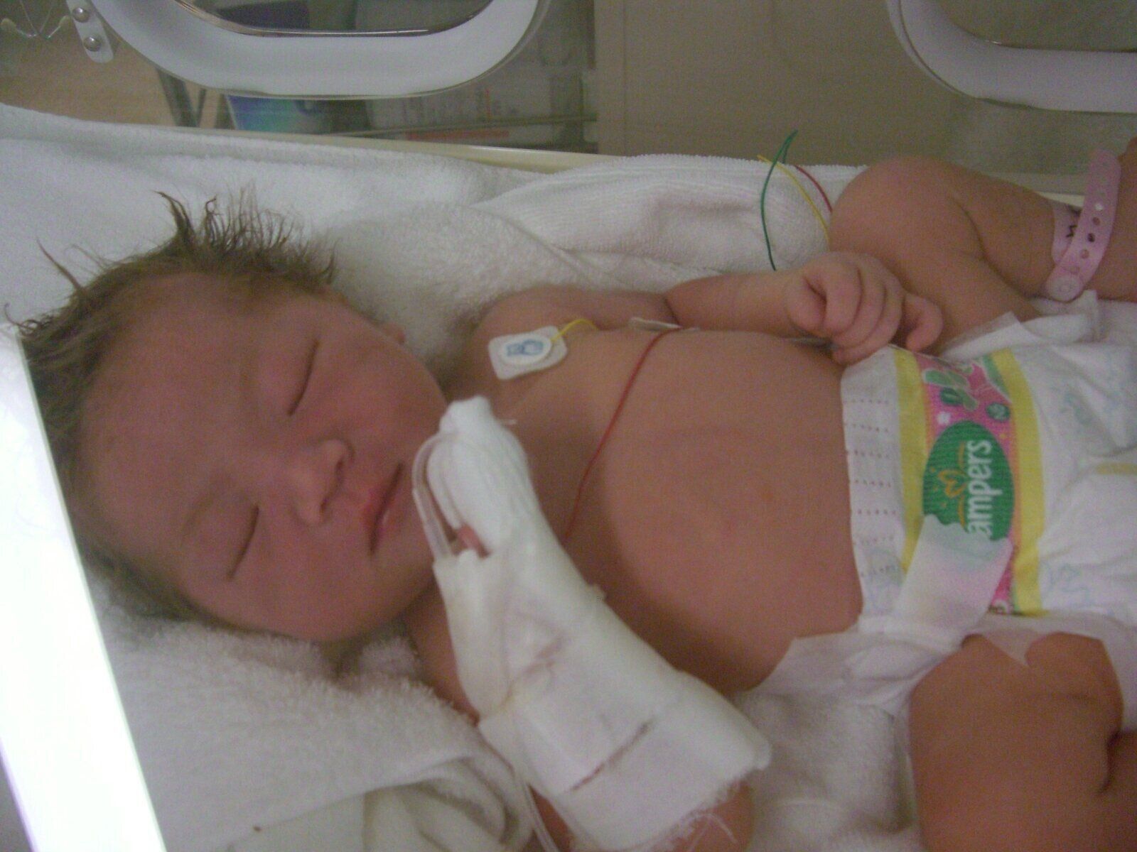 新生児の愛夕さん