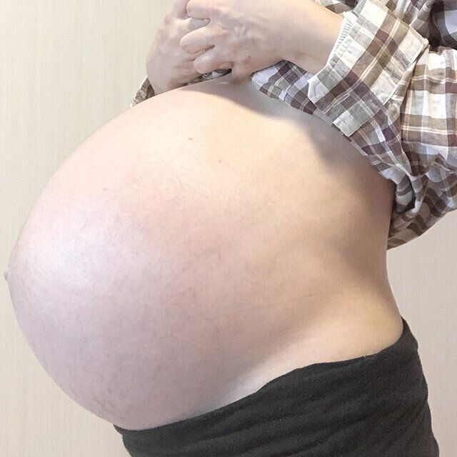 ４つ子妊娠出産体験談よつはさん　妊娠29週頃のおなか