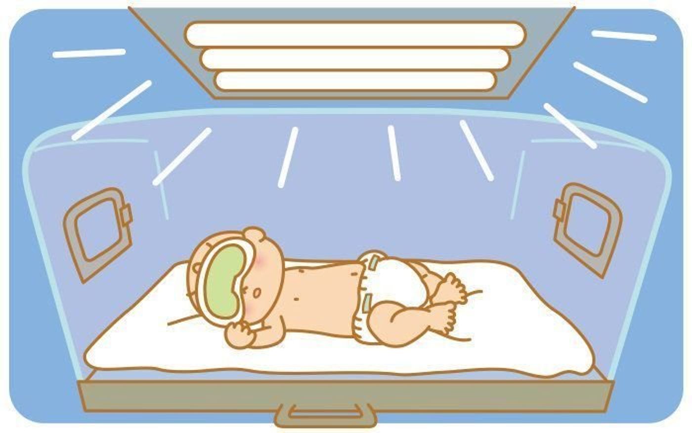 赤ちゃん 新生児の病気 新生児黄疸の症状とケア 医師監修 たまひよ 赤ちゃん 新生児の病気 新生児黄疸の症状とケア 医師監修 たまひよ