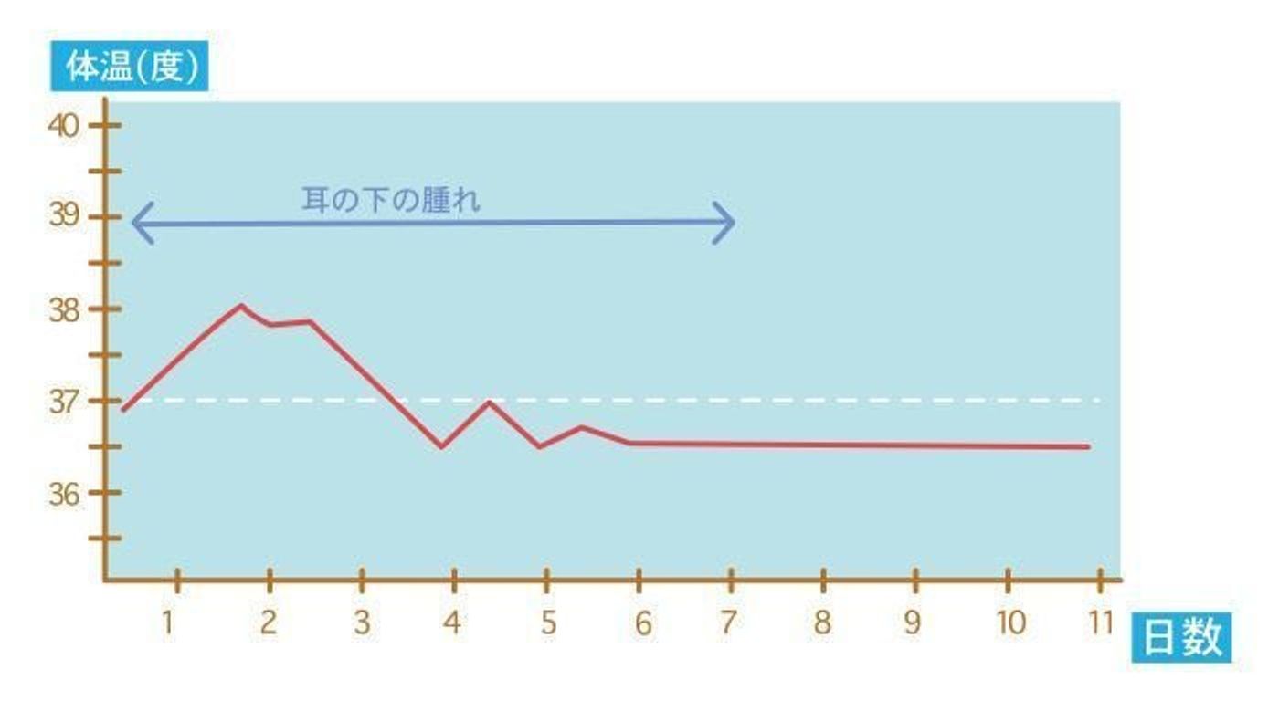 医師監修 赤ちゃんの感染症 おたふくかぜ 流行性耳下腺炎の症状とケア たまひよ 医師監修 赤ちゃんの感染症 おたふくかぜ 流行性耳下腺炎の症状とケア たまひよ