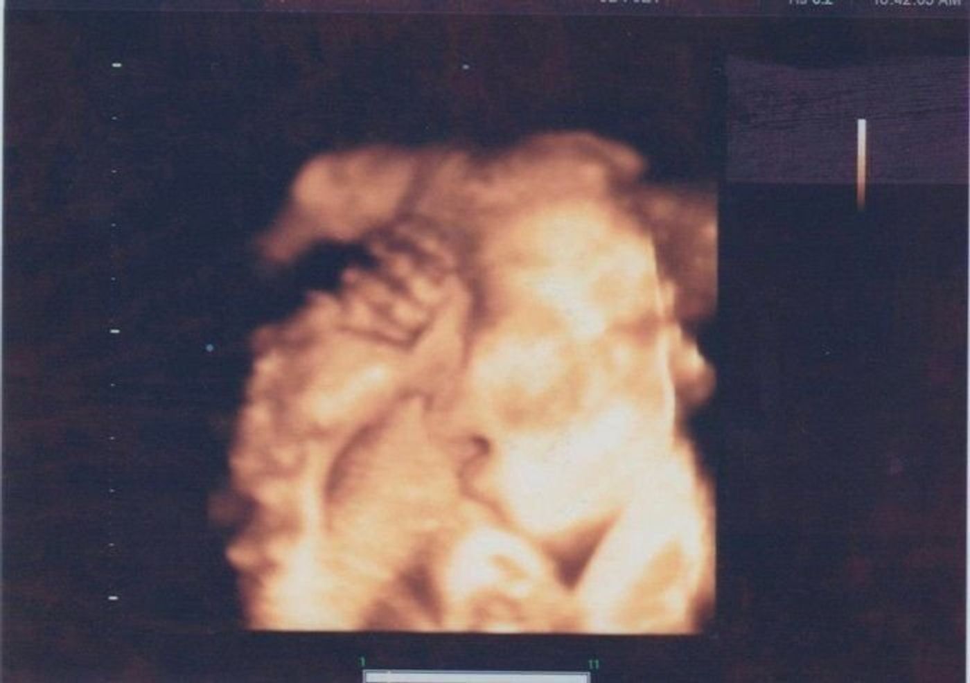 妊娠31週 赤ちゃんのエコー写真 超音波写真まとめ たまひよ 妊娠31週 赤ちゃんのエコー写真 超音波写真まとめ たまひよ