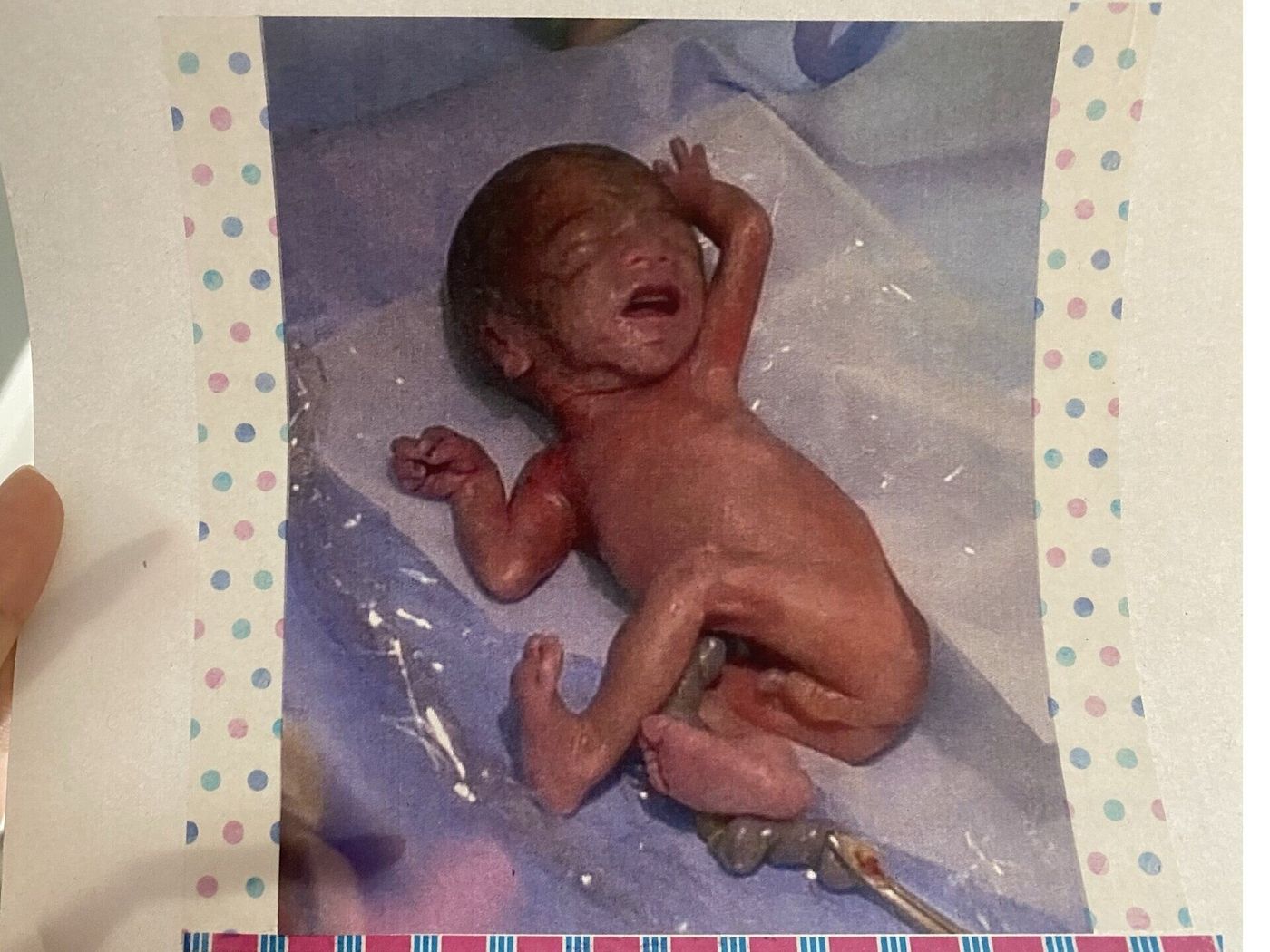 27週で558gの赤ちゃんを出産 小さすぎて泣かないと言われていたわが子から ふにゃ と産声が 思わず涙があふれた 体験談 医師監修 たまひよ 27週で558gの赤ちゃんを出産 小さすぎて泣かないと言われていたわが子から ふにゃ と産声が 思わず涙があふれた 体験談 医師監修 たまひよ