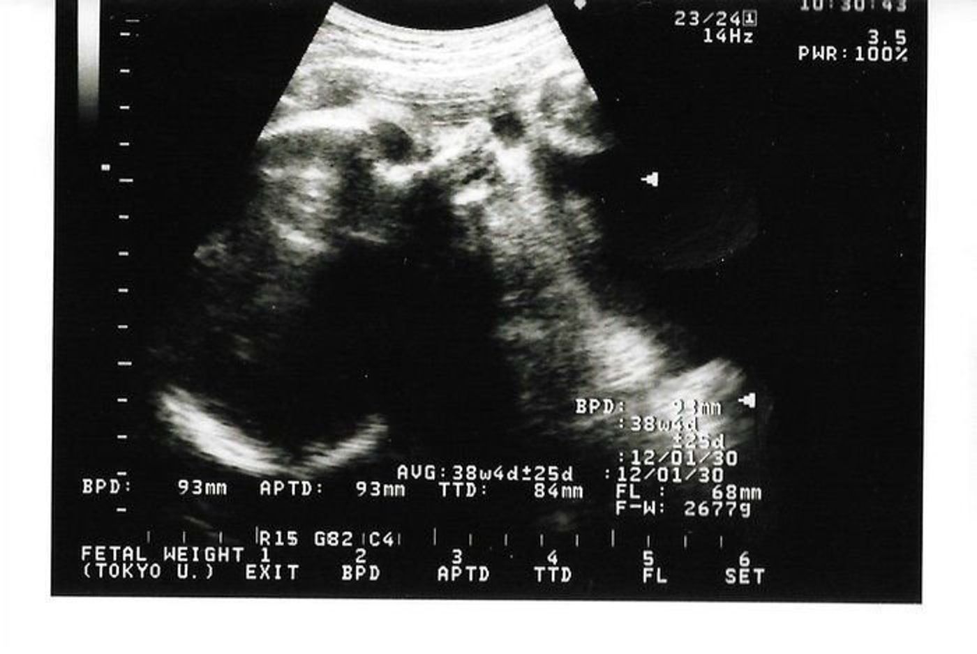 妊娠36週 赤ちゃんのエコー写真 超音波写真まとめ たまひよ 妊娠36週 赤ちゃんのエコー写真 超音波写真まとめ たまひよ