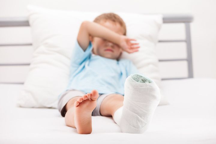 脚の骨折お子様のヒールまたはプロークン足骨プラスターバンデージニット