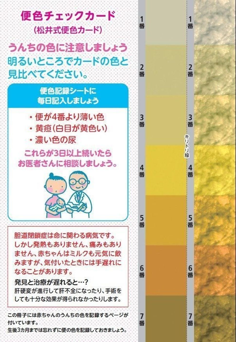 赤ちゃんの便の色が手がかり 難病 胆道閉鎖症 見逃しを防ぐには たまひよ 赤ちゃんの便の色が手がかり 難病 胆道閉鎖症 見逃しを防ぐには たまひよ
