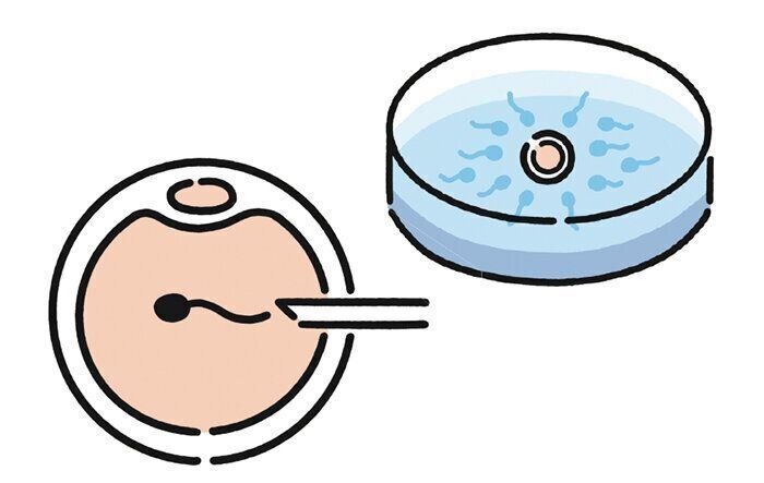 体外受精・顕微授精