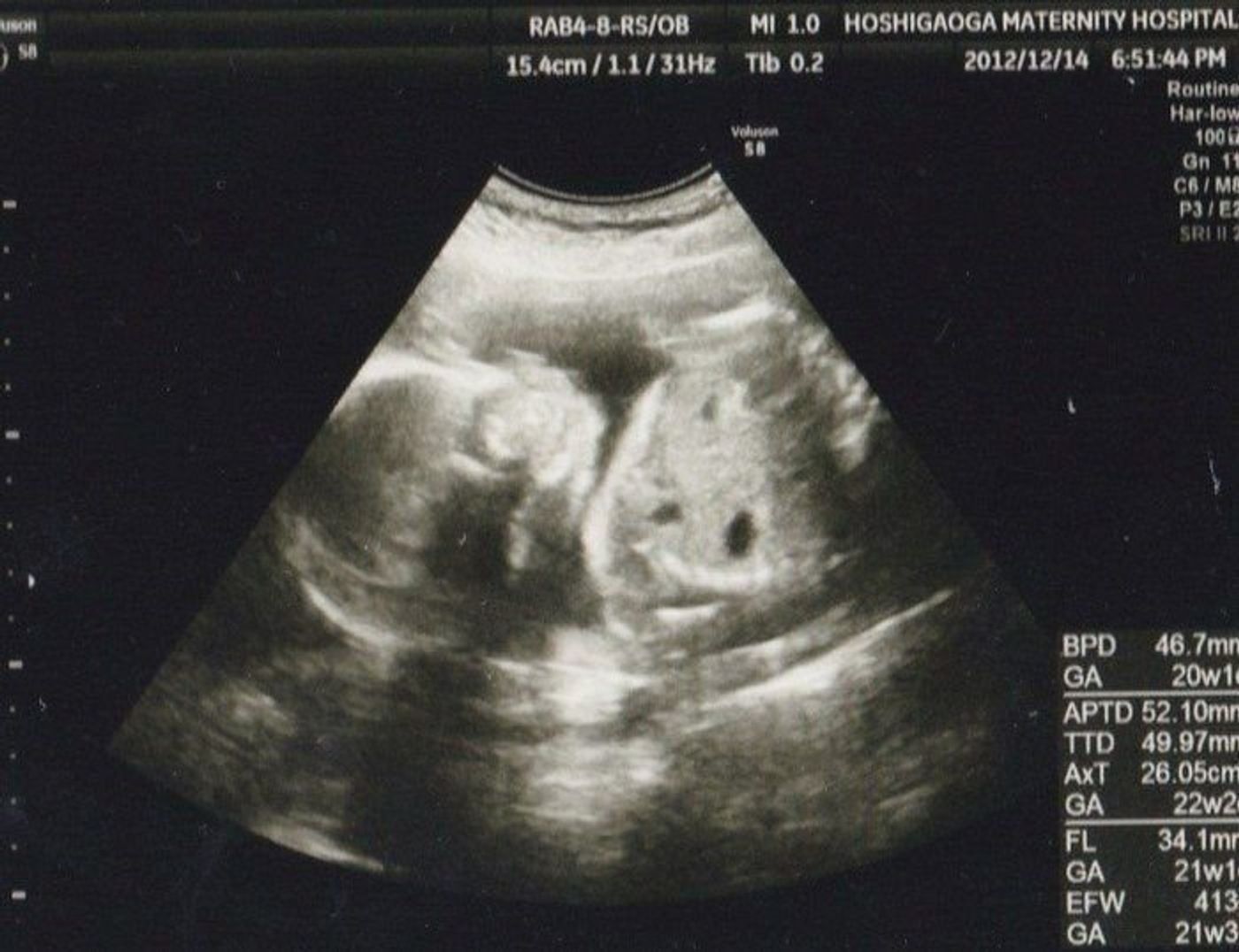 妊娠21週 赤ちゃんのエコー写真 超音波写真まとめ たまひよ 妊娠21週 赤ちゃんのエコー写真 超音波写真まとめ たまひよ