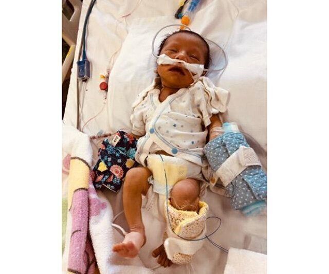 医療的ケア児育児・出産体験談　仲谷さやかさんインタビュー