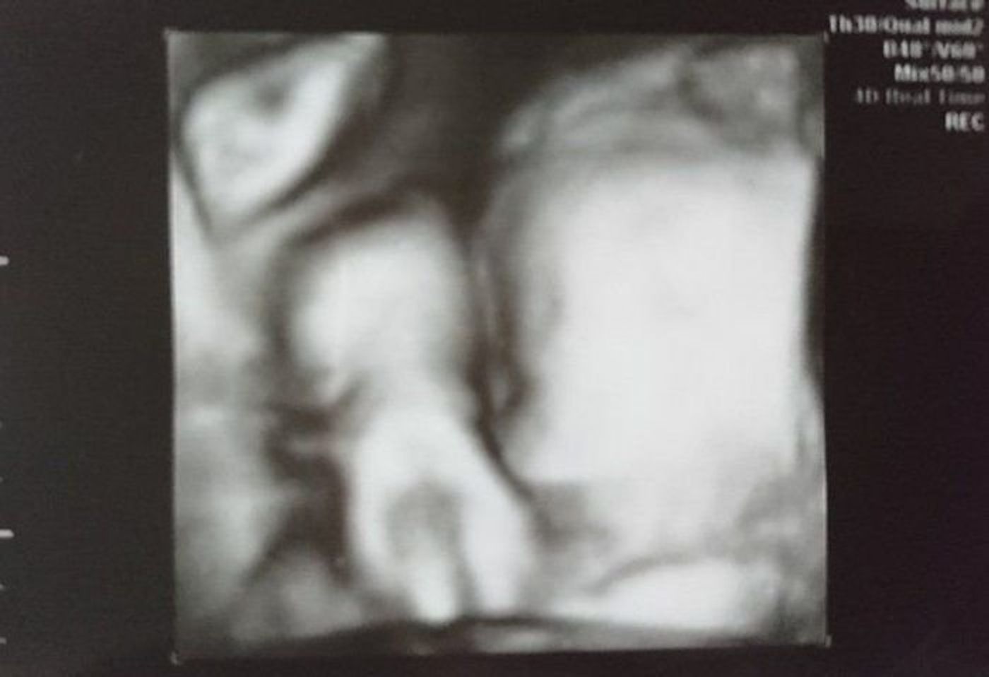 妊娠31週 赤ちゃんのエコー写真 超音波写真まとめ たまひよ 妊娠31週 赤ちゃんのエコー写真 超音波写真まとめ たまひよ