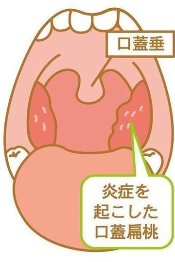 のどちんこの腫れを放っておかないほうがいい 5つのシビアな理由 ウーマンエキサイト 1 4