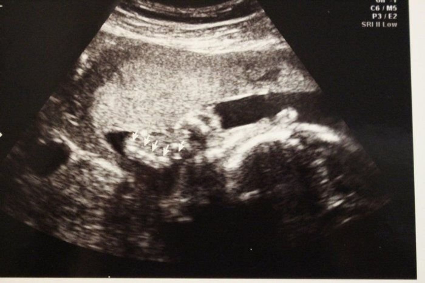 妊娠25週 赤ちゃんのエコー写真 超音波写真まとめ たまひよ 妊娠25週 赤ちゃんのエコー写真 超音波写真まとめ たまひよ