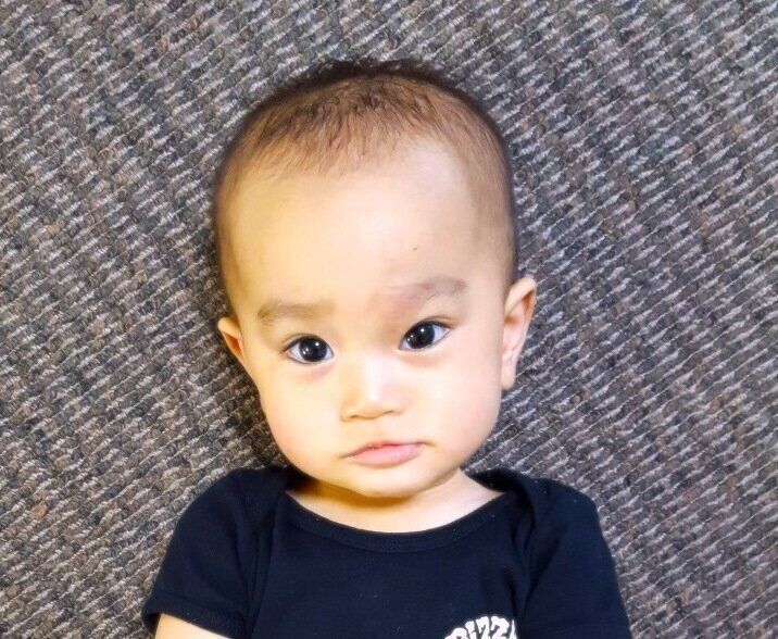 生後1カ月の娘 目の上のあざが 日ごとに大きく 自分を責め続けた日々 体験記 たまひよ