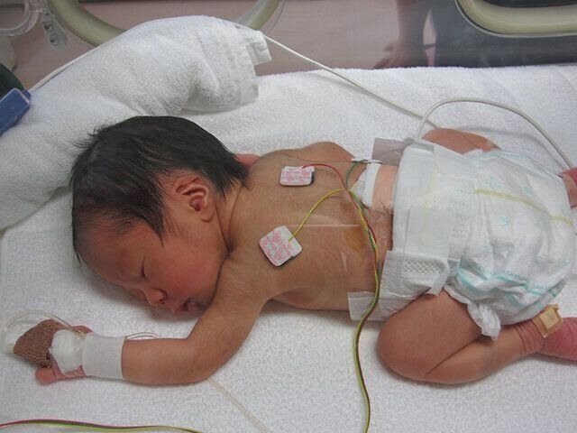 水頭症・ウエスト症候群・全盲のそう君のママ　山下祐子さんインタビュー