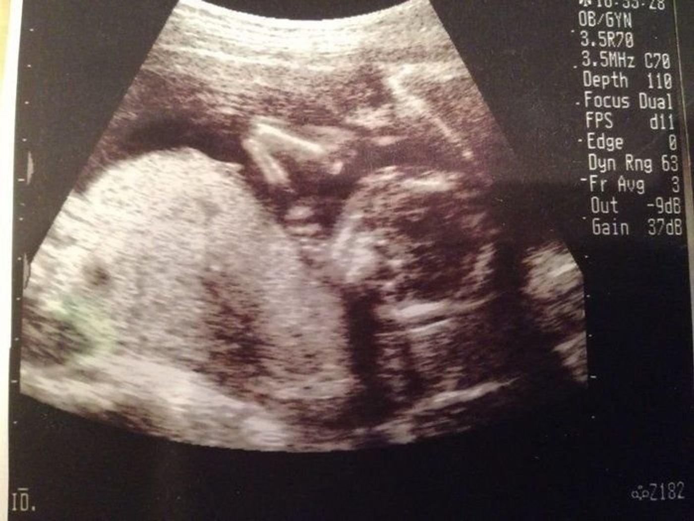 妊娠16週 赤ちゃんのエコー写真 超音波写真まとめ たまひよ 妊娠16週 赤ちゃんのエコー写真 超音波写真まとめ たまひよ