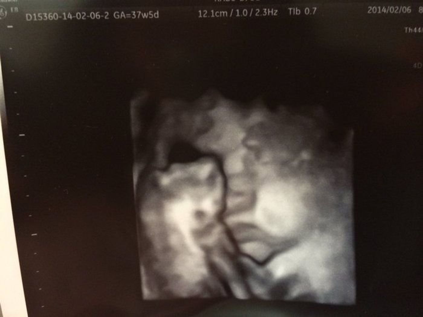 妊娠37週 赤ちゃんのエコー写真 超音波写真まとめ たまひよ 妊娠37週 赤ちゃんのエコー写真 超音波写真まとめ たまひよ