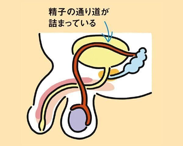 【精路閉塞】症状・原因