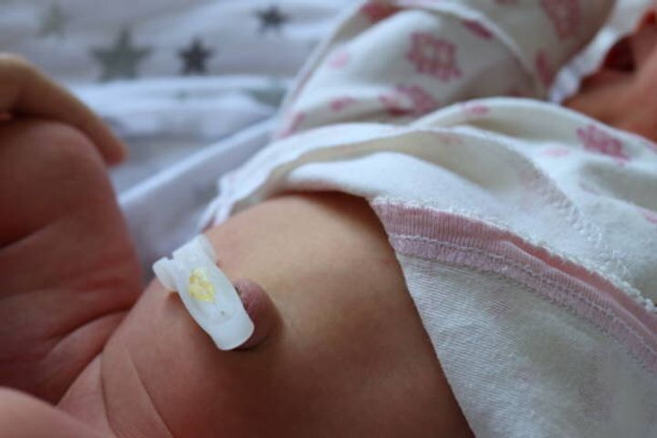プラスチックへそクランプを持つ新生児