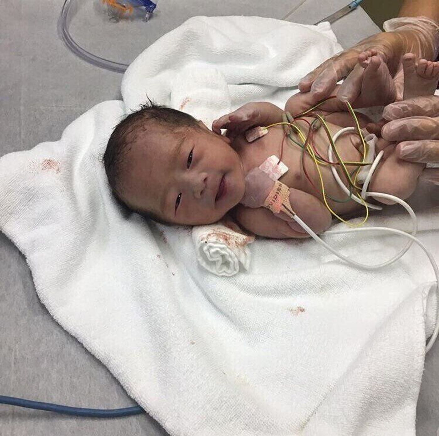 重度の心臓病で生まれたわが子 何度も生死をさまよい 開胸したまま手術室から帰ってきたことも 息子に付き添ううちに 母に芽生えたある決意 たまひよ 重度の心臓病で生まれたわが子 何度も生死をさまよい 開胸したまま手術室から帰ってきたことも 息子に付き添ううちに 母に芽生えたある決意 たまひよ