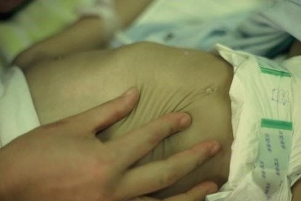 ロタウイルスワクチン 時期が来たら必ず接種を 10月の定期化まで待たないで 小児科医 たまひよ ロタウイルスワクチン 時期が来たら必ず接種を 10月の定期化まで待たないで 小児科医 たまひよ