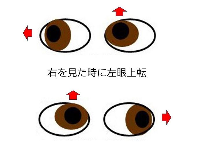 目の位置が変?これって斜視!?気づいてあげることが大切【ママ眼科医】|たまひよ