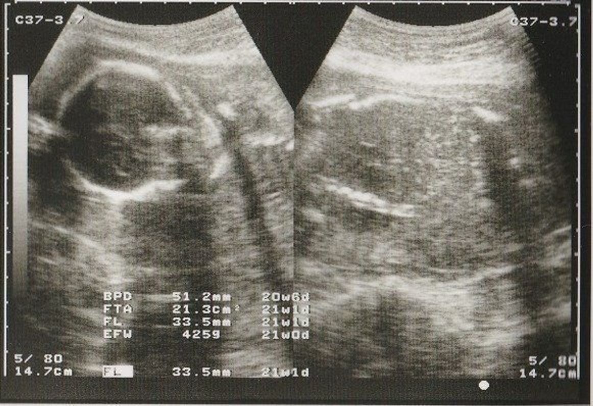 不妊治療や2度の流産経験を経て 初めての出産 日々成長する胎児の記録をエコー画像で振り返る たまひよ 不妊治療や2度の流産経験を経て 初めての出産 日々成長する胎児の記録をエコー画像で振り返る たまひよ