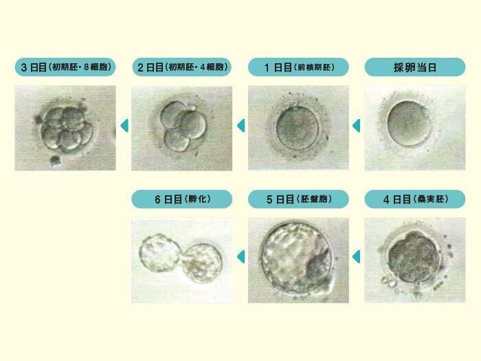 受精後、胚は2日目には4細胞、3日目には8細胞に分裂し、どんどん細胞を増やしていきます。4日目には細胞同士がくっつき桑実胚になり、5日目には赤ちゃんになる部分と胎盤になる部分が形成される胚盤胞になります。ここまで発育できるのは40~50%です。胚凍結は通常、3日目か5日目に行われます。融解後は2日程で孵化(ハッチング)をし移植、着床を確認します。
